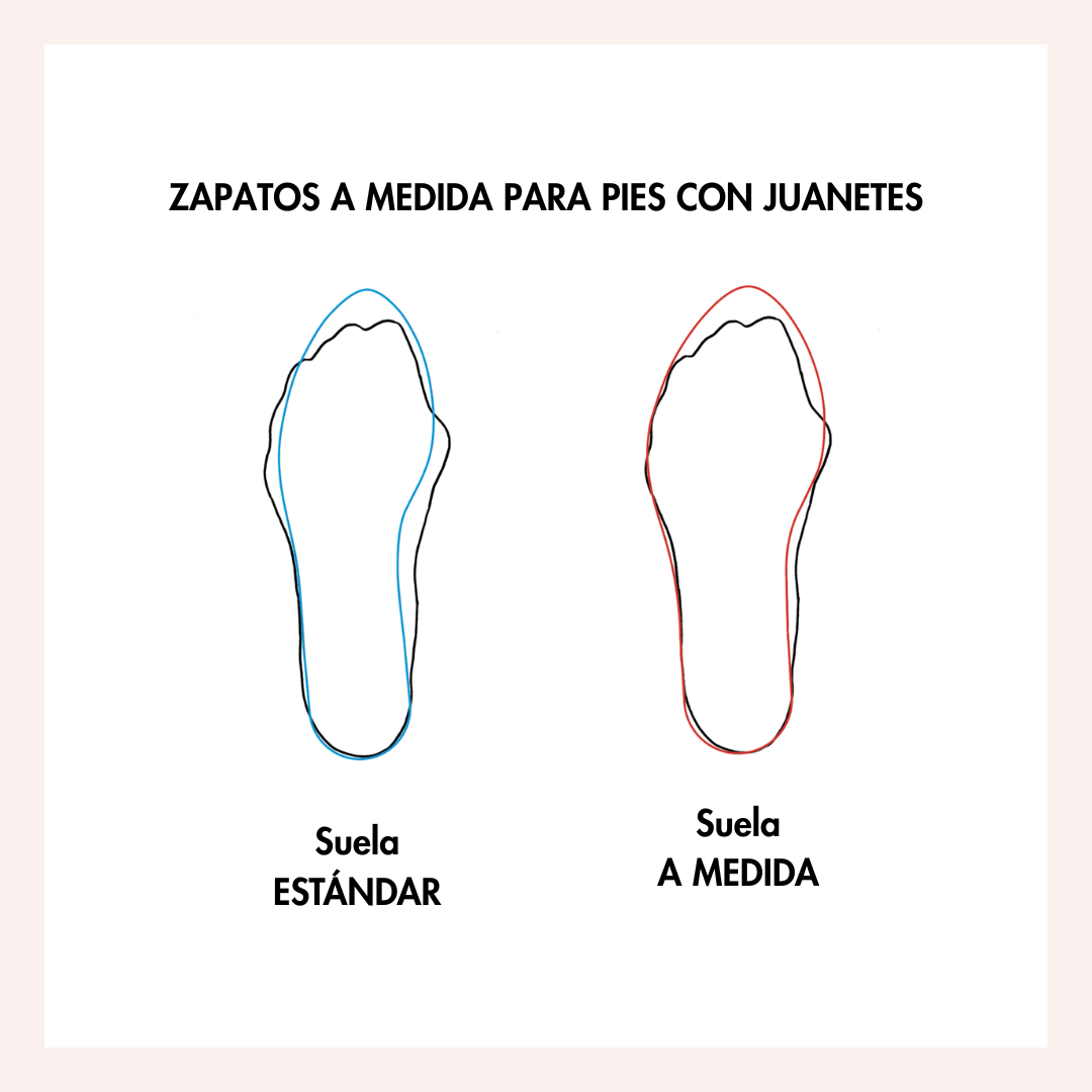 Zapatos elegantes y cómodos para pies con juanetes